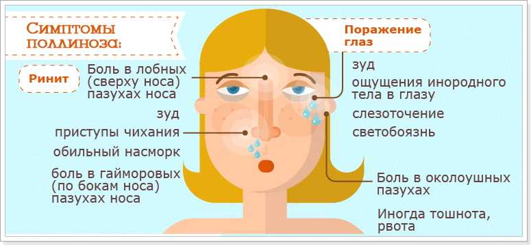 Сезонная аллергия у взрослых - симптомы, причины, профилактика и лечение